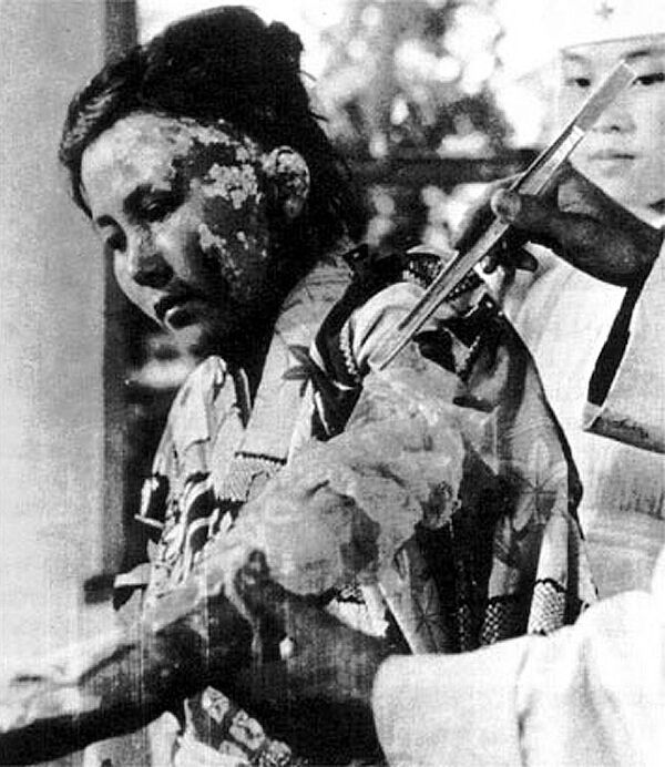 Opfer des Atombombenabwurfs in Hiroshima Bildquelle: WikiPedia Opfer des Atombombenabwurfs in Hiroshima Bildquelle: WikiPedia